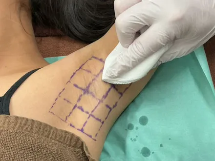 臭いや汗の状態の確認