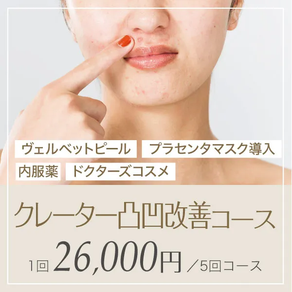クレーター凸凹改善コース