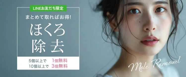 ホクロ除去