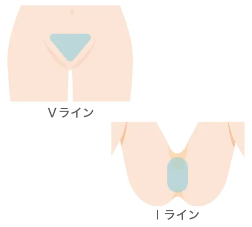 すそわきが